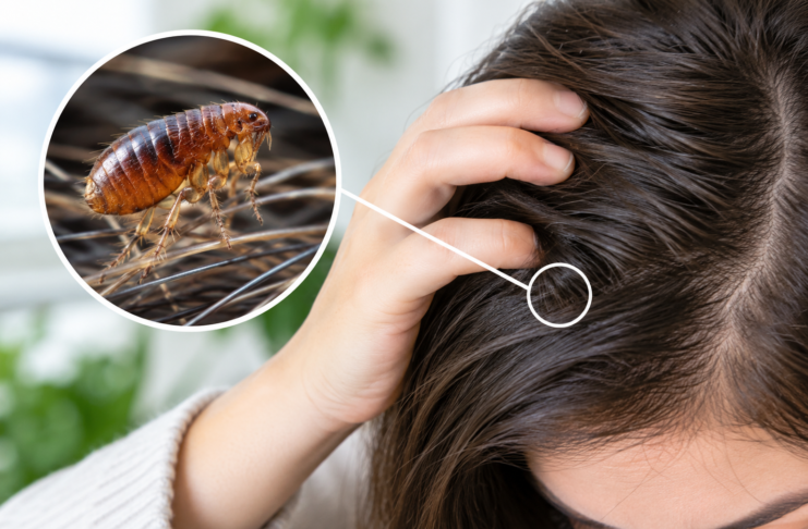 Can Fleas Live in Human Hair